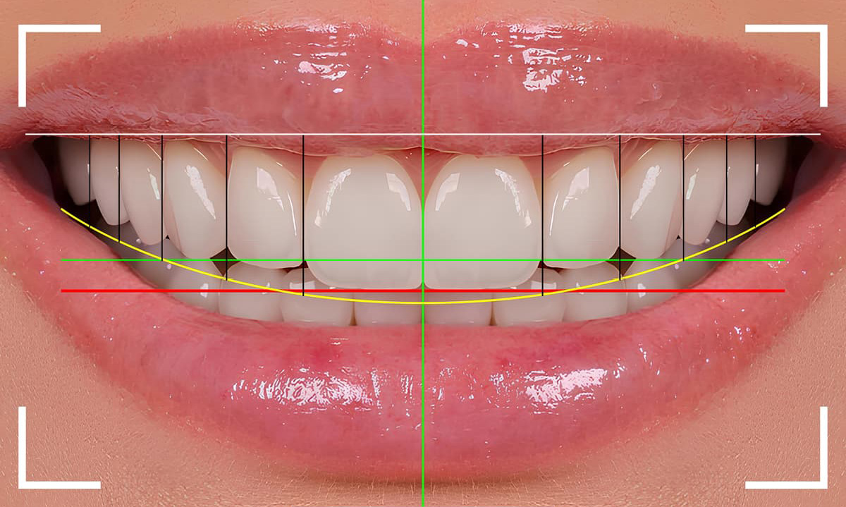 Smile Design at Traviesas Dental Care